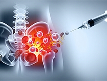 Biologic Injections and Healing Potential: What Current Evidence Actually Suggests