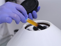 Biologic Options for the Hip: How PRP Supports Joint Preservation