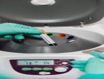 Is PRP Injection Safe?