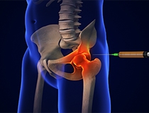 Targeting the Source: Why Ultrasound-Guided Precision Matters in Hip Injections