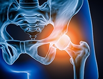The Hidden Factor That Determines Whether Hip Treatments Succeed or Fail