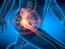 The Missing Piece in Biologic Treatment Plans for Hip Pain