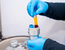 What Are Orthobiologics? A Guide to Natural Healing for Hip Pain