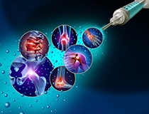Why Biologic Injections Are Not a Replacement for Surgery - But Sometimes a Bridge