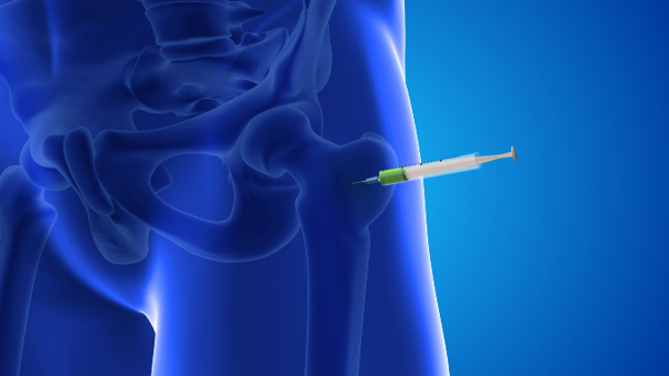 A Few Millimeters Matter: Why Image-Guided Hip Injections Can Significantly Affect Accuracy and Outcomes