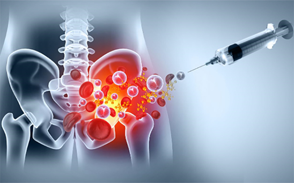 Biologic Injections and Healing Potential: What Current Evidence Actually Suggests